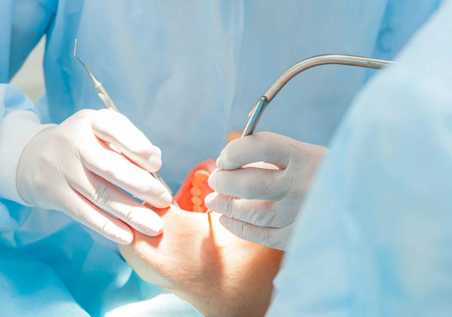 Anesthésie générale