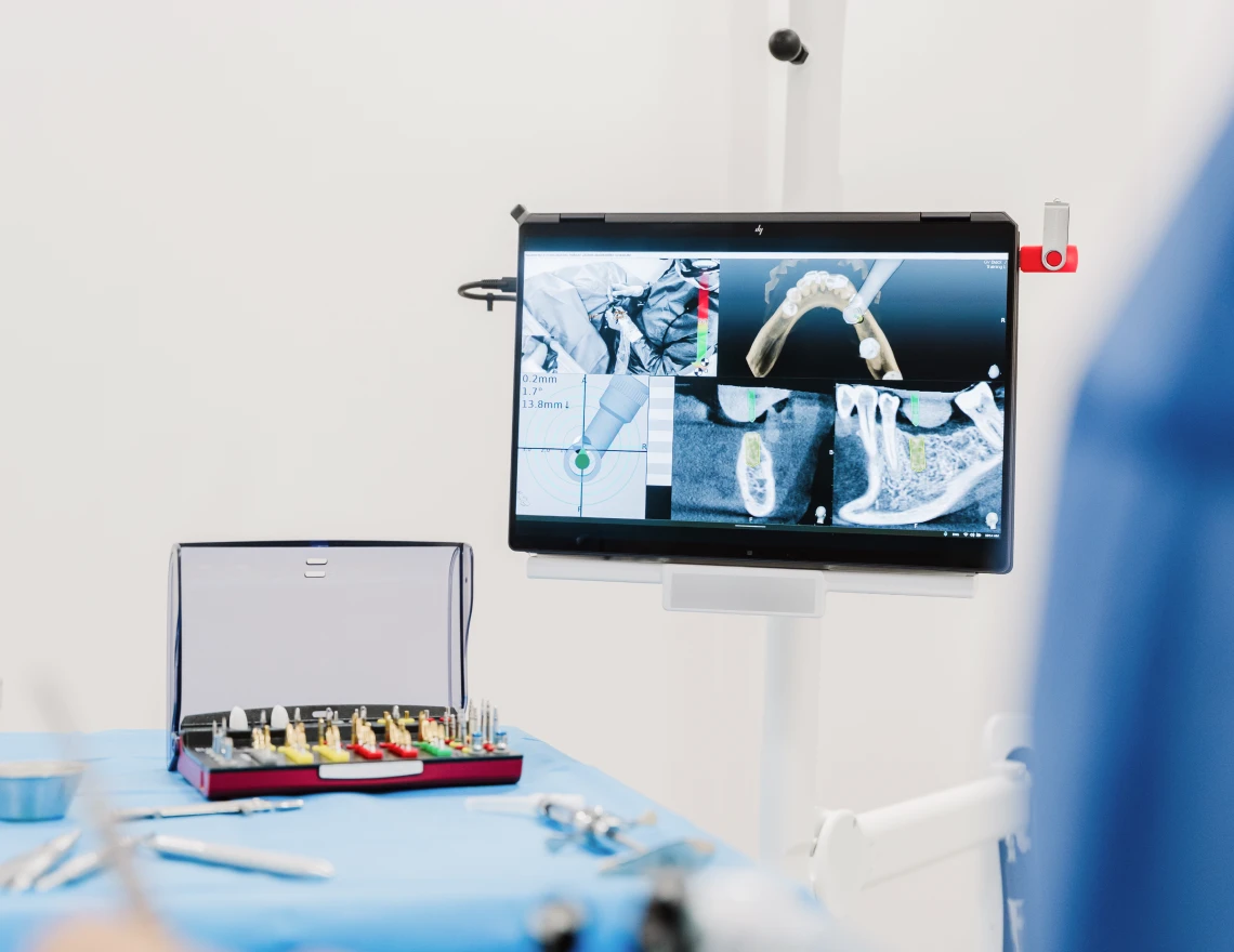 La chirurgie naviguée fournit une visualisation précise de l’anatomie du patient