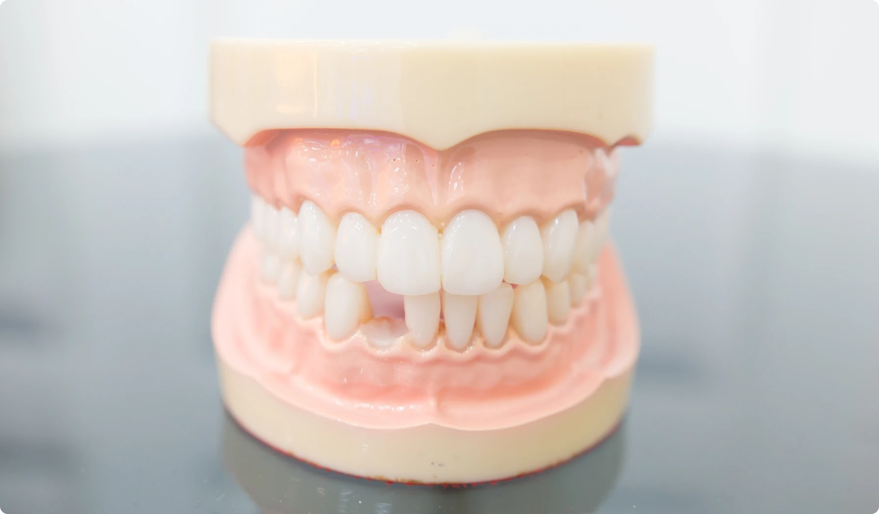 Prévention de la perte de dents à Grenoble 38000